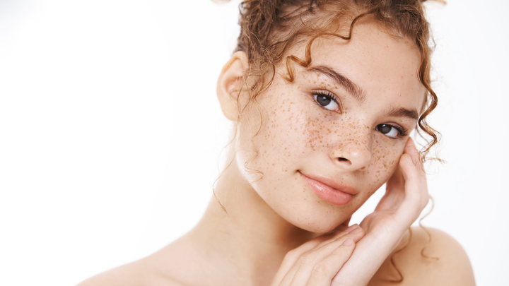 Young model with freckles with her hands by her face