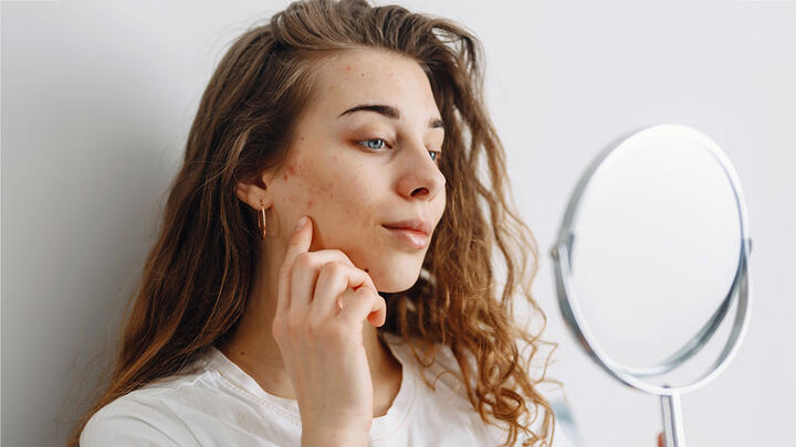 Beautiful curly woman with blemishes