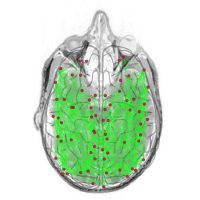 @neurolib-dev