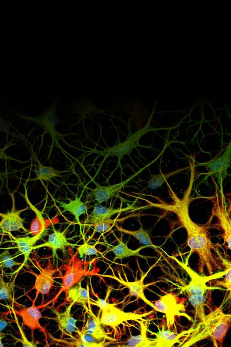 Clusters of green, yellow, red and orange vein-like figures with circles at their center.