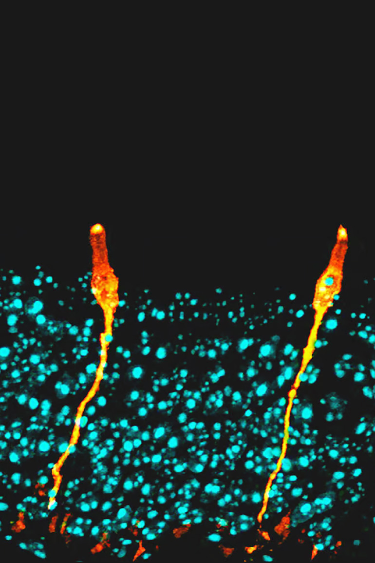 Pulmonary ionocytes (orange) extend through neighboring epithelial cells in the upper respiratory tract of the mouse, to the surface of the epithelial lining; cell nuclei in cyan.