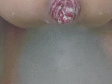 Amazing Prolapse gif