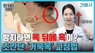 버섯목에 목디스크까지 생긴다? 거북목이면 꼭! 이렇게만 따라하세요 | 거북목/버섯목/일자목 교정 효과