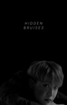 Hidden Bruises (vhope)  cover