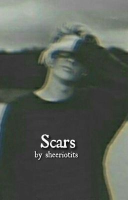 Scars||Ed Sheeran cover