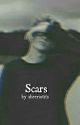 Scars||Ed Sheeran by sheeriotits