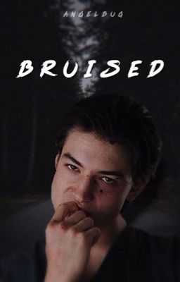 BRUISED ➝ reddie | ✓ cover