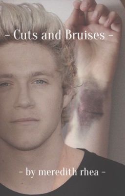 - Cuts and Bruises -  - Niall Horan - cover