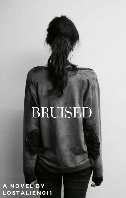 Bruised by lostalien011