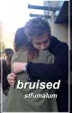 Bruised// l.h au by emrosefitzgerald