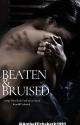 Beaten & Bruised by AmberElizabeth1991