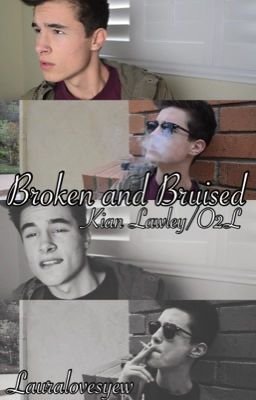 Broken and Bruised-Kian Lawley/O2L cover