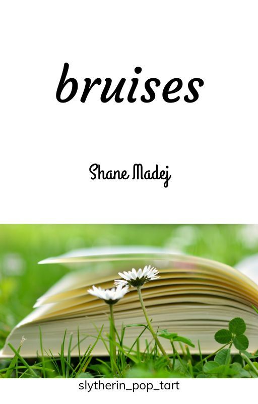 Bruises- Shane Madej by Slytherin_Pop_Tart