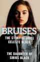 Bruises ( Ariel Celeste Black) by VBlack169