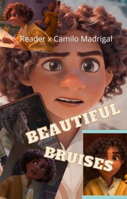 Beautiful Bruises ~ Camilo Madrigal x Reader cover