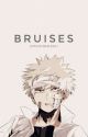 bruises  [Bakugou] by valwmi