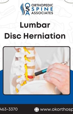 Lumbar disc herniation by okorthospine