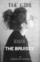 The girl beneath the bruises by kindaextraordinary