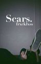 Scars. [ BORRADOR ] by frxcklxss