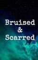 Bruised & Scarred by SettleDown1D