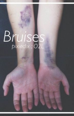 Bruises ; O2L by pixiedix