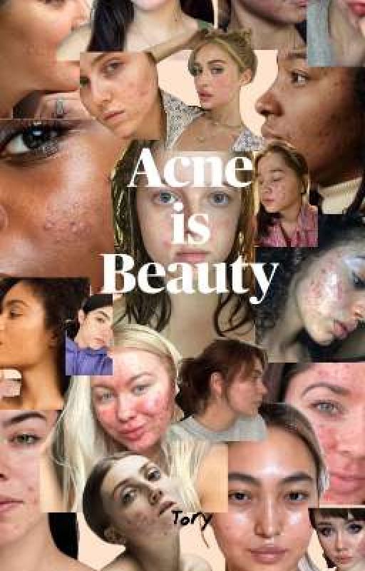 Acne is BEAUTY by cherrylueur