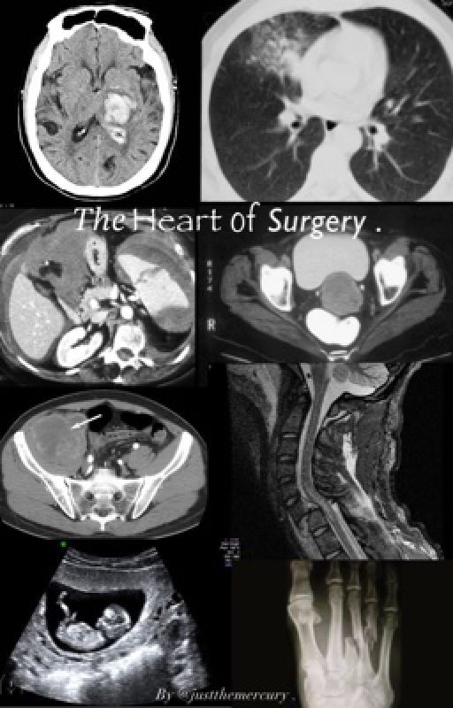 The Heart of Surgery. Book One. by inmymercuryERAA