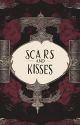 Scars and Kisses |  16 by xchatea