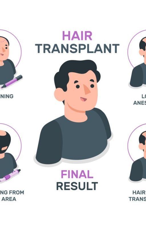 Hair Transplant Cost in India and the Best Hair Transplant Clinic in India by mdaman00khan