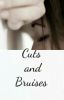 Cuts and Bruises