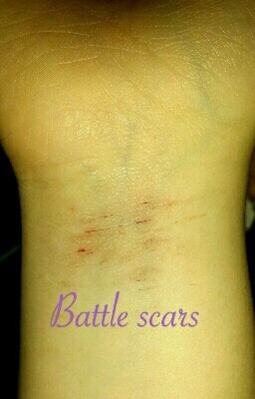 Battle Scars  by first_satan