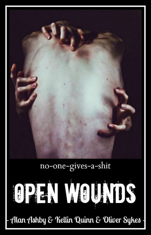 Open Wounds // Alan Ashby, Kellin Quinn, Oliver Sykes ✓ by no-one-gives-a-shit