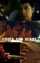 Kisses and Scars (Book 1 of Kisses & Scars Duology) by EXO-FAN-253