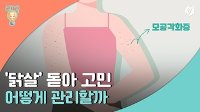 [리빙톡] '닭살' 돋아 고민…어떻게 관리할까