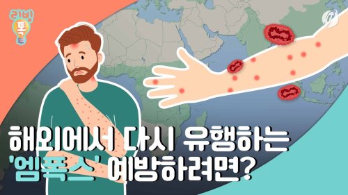  해외에서 다시 유행하는 엠폭스…예방하려면?