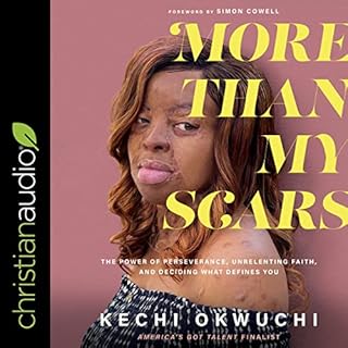 More than My Scars Audiolibro Por Kechi Okwuchi, Simon Cowell - foreword arte de portada