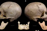 Ancient Egyptian Skull May Have Been Among First Attempts to Treat Cancer