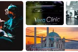 My Hair Transplant Adventure with Vera Clinic in Istanbul, Turkey