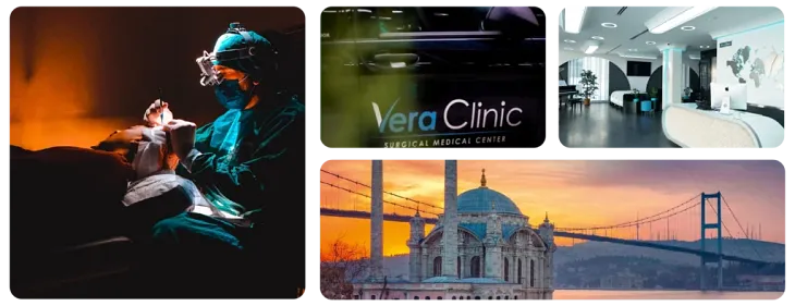 My Hair Transplant Adventure with Vera Clinic in Istanbul, Turkey