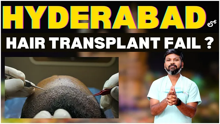 Is it true that hair transplant procedures performed in Hyderabad have a higher failure rate when…