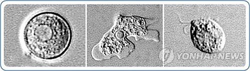 뇌 먹는 아메바./출처=연합뉴스