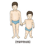 연골무형성증