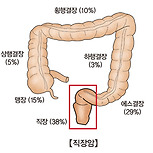 직장암