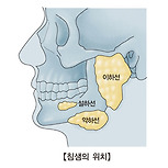 타액선암