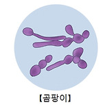 곰팡이 감염