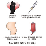 후천성 면역결핍증