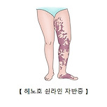 헤노호 쉰라인 자반증