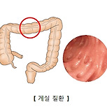 메켈 게실