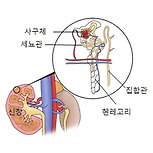 급성 간질성 신염