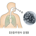 파라인플루엔자 감염증